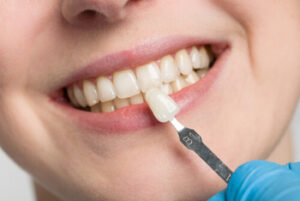 Full Set Of Veneers Cost Australia aesthetics pyrmont
