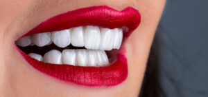 Full Set Of Veneers Cost Australia results pyrmont