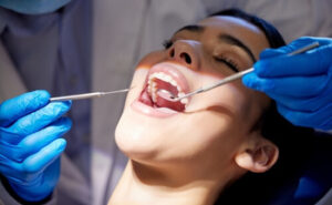 Signs Of Bad Veneers checking