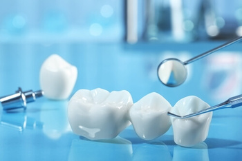 Tooth Crown Before and After: A Complete Guide