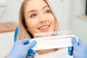 Hydrogen Peroxide Teeth Whitening colour