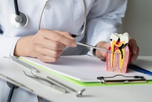 How To Remove Tooth Decay Yourself check