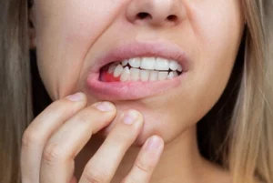 Does Gingivitis Cause Bad Breath pain