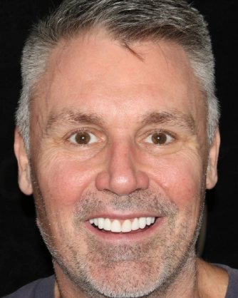 Man smiling teeth visible