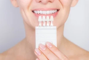 patient holding veneer samples to check colour