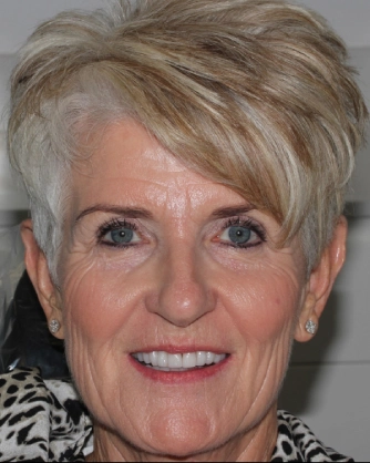 Woman short hair smiling teeth visible