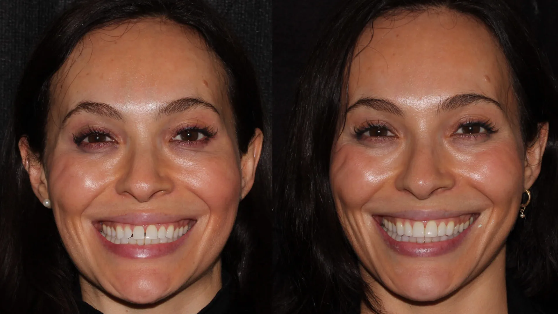 Side-by-side close-up of a woman smiling