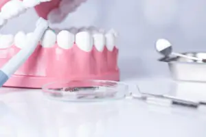 cost of composite veneers pyrmont